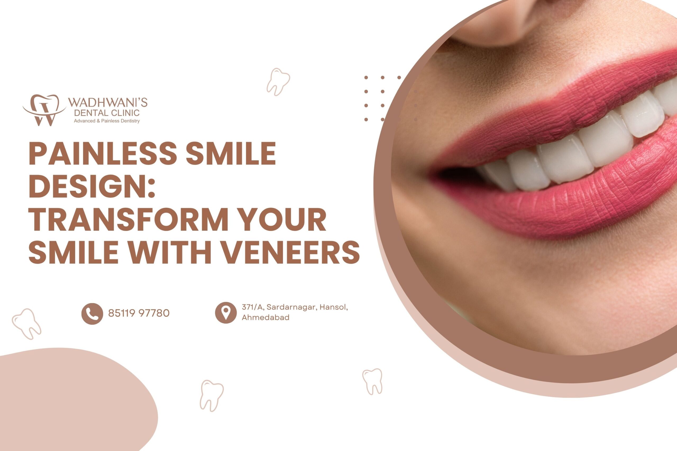 Painless Smile Design: Transform Your Smile with Veneers