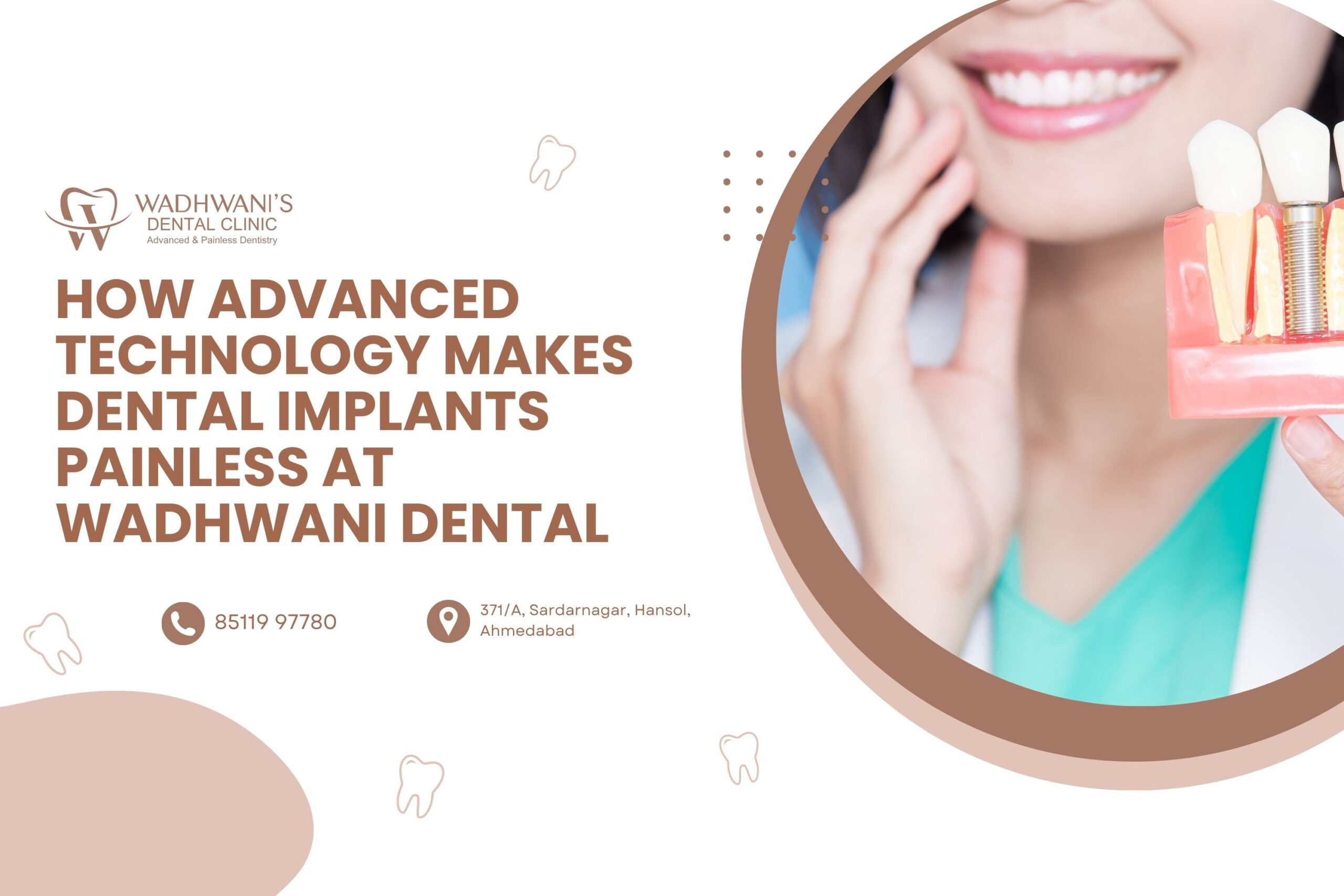 How Advanced Technology Makes Dental Implants Painless at Wadhwani Dental