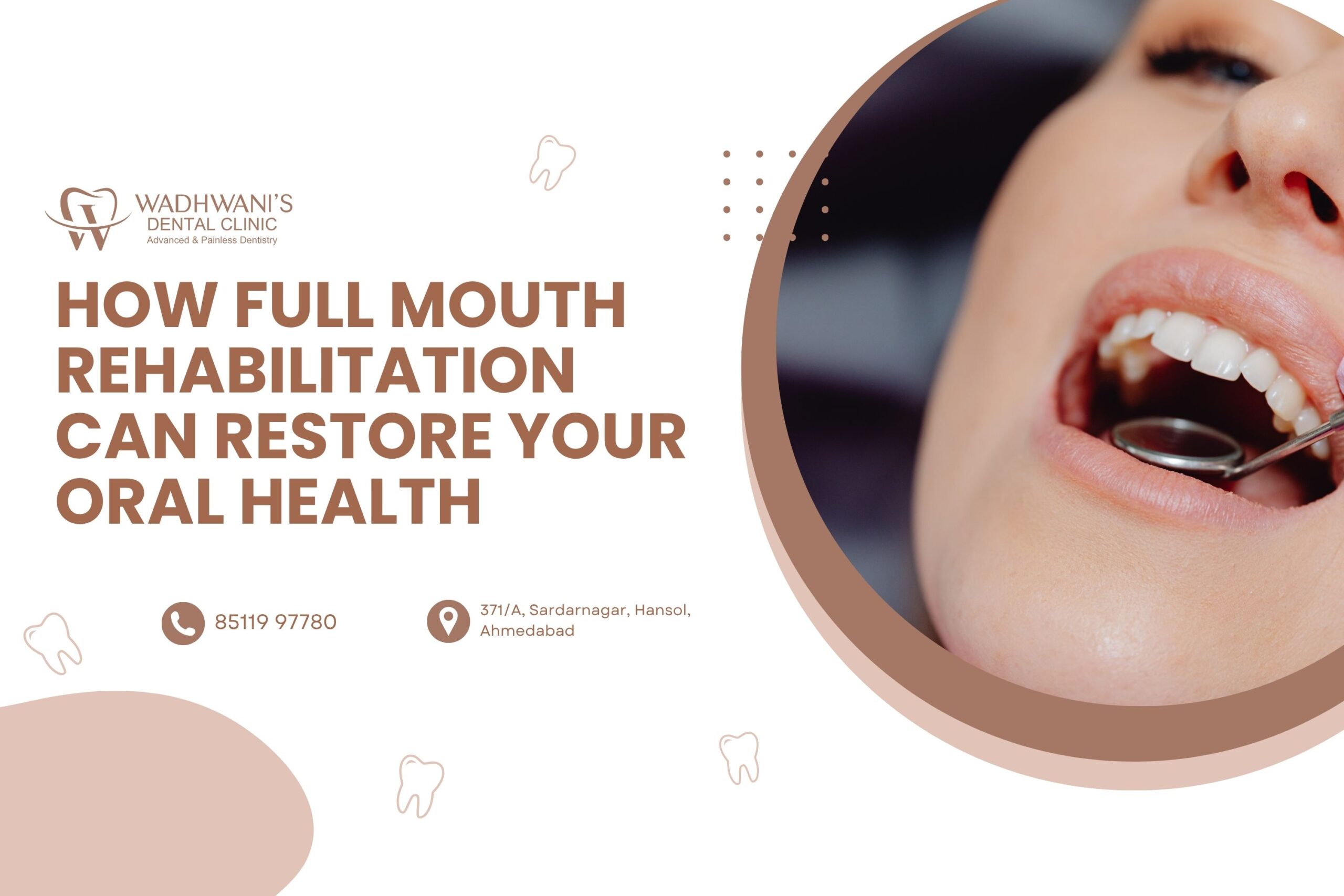 How Full Mouth Rehabilitation Can Restore Your Oral Health