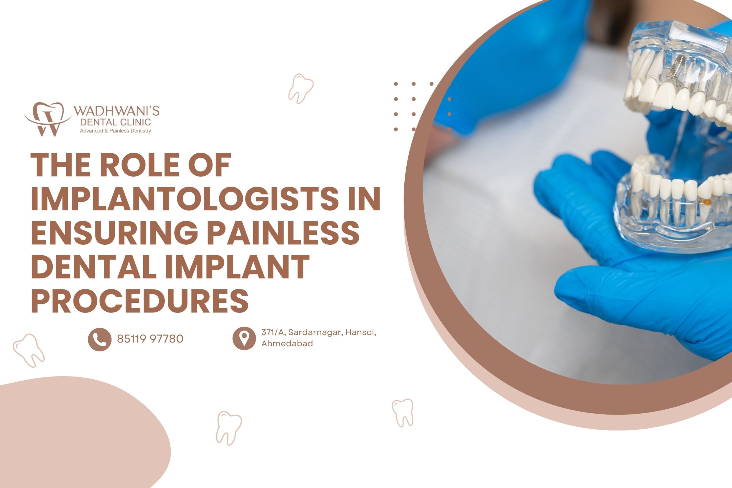 The Role of Implantologists in Ensuring Painless Dental Implant Procedures