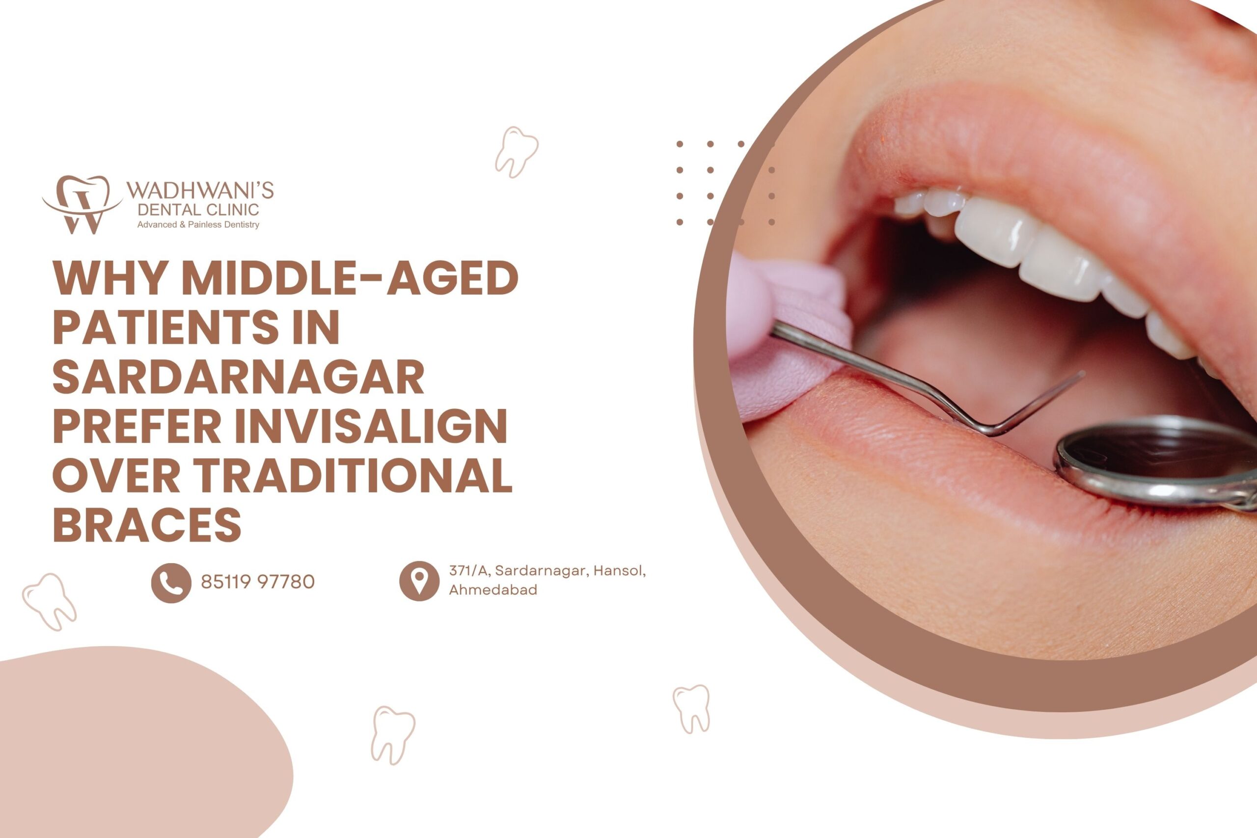 Why Middle-Aged Patients in Sardarnagar Prefer Invisalign Over Traditional Braces